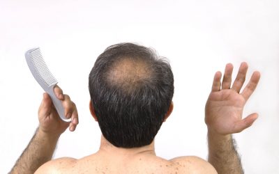 Comment soigner la perte de cheveux chez l’homme ?